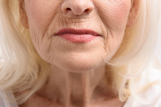 Microneedling for Smokers Lines