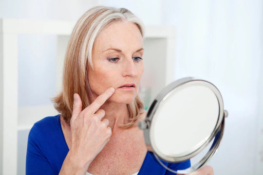 Microneedling Marionette Lines