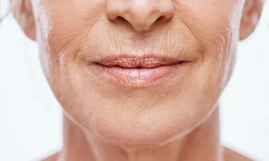 Microneedling for Wrinkles