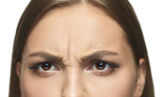 Rides du lion ? Rides du front ? Pattes-d’oie ? Comment traiter certaines zones du visage sans avoir recours au Botox
