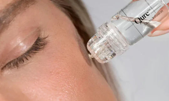 What is True of Microneedling?