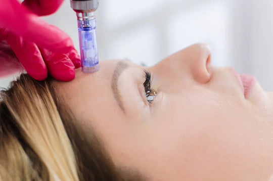 Microneedling Sensitive Skin
