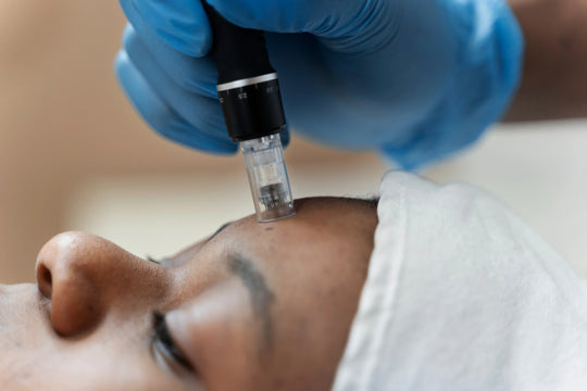 À quelle fréquence faire du microneedling ?