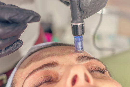 Quelles sensations procure le microneedling ?